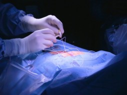 На Дальнем Востоке провели уникальную операцию по устранению дисфункций органов малого таза