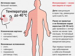 В Якутии корью заболел 51 человек 