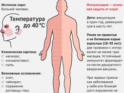 В Якутске зарегистрировано 29 случаев кори 