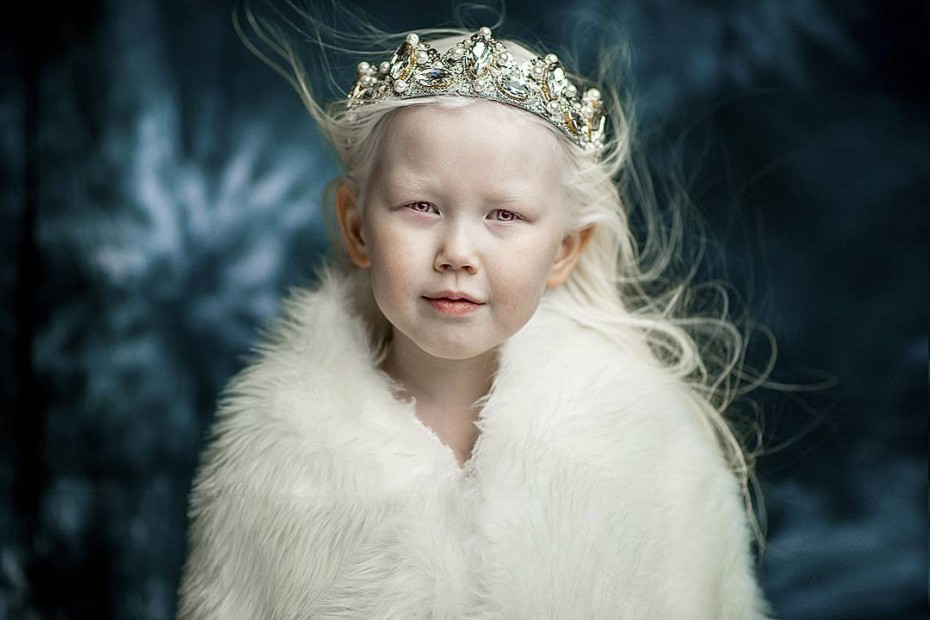 Маленькая якутянка-альбинос покорила пользователей соцсетей
