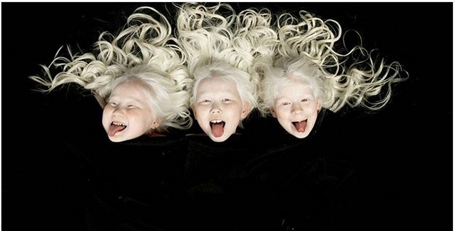 Девочек-альбиносов из Якутии назвали ведьмами