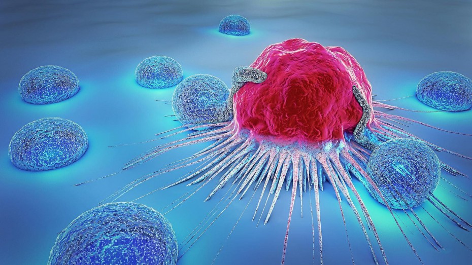 Искусственный интеллект предскажет развитие раковой опухоли