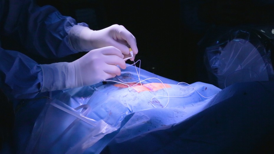 На Дальнем Востоке провели уникальную операцию по устранению дисфункций органов малого таза