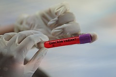Стелс-омикрон назвали самым заразным за всю историю пандемии
